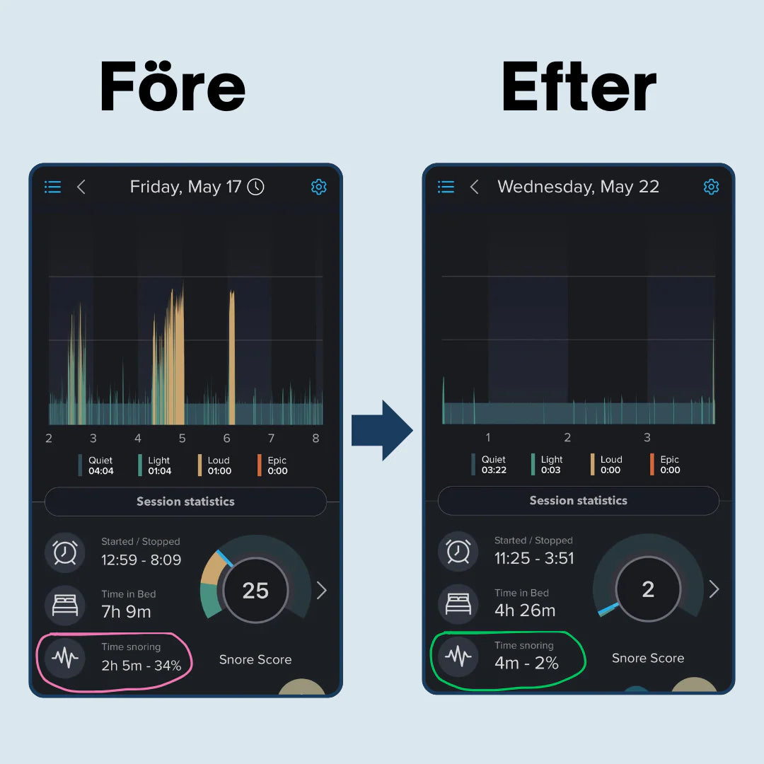 Snore Free Pro – Sleep quieter, breathe easier, wake up more alert.