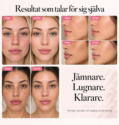 Ansiktskräm mot pigmentfläckar