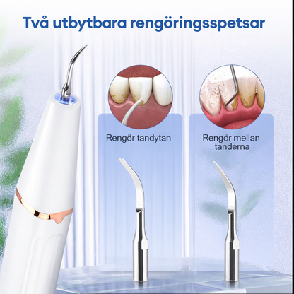 GlowSmile™ – Ultrasonic cleaning