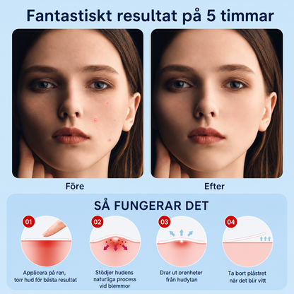 Patches - let the skin recover in peace