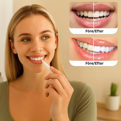 Teeth whitening pen – Clinically inspired whitening at home