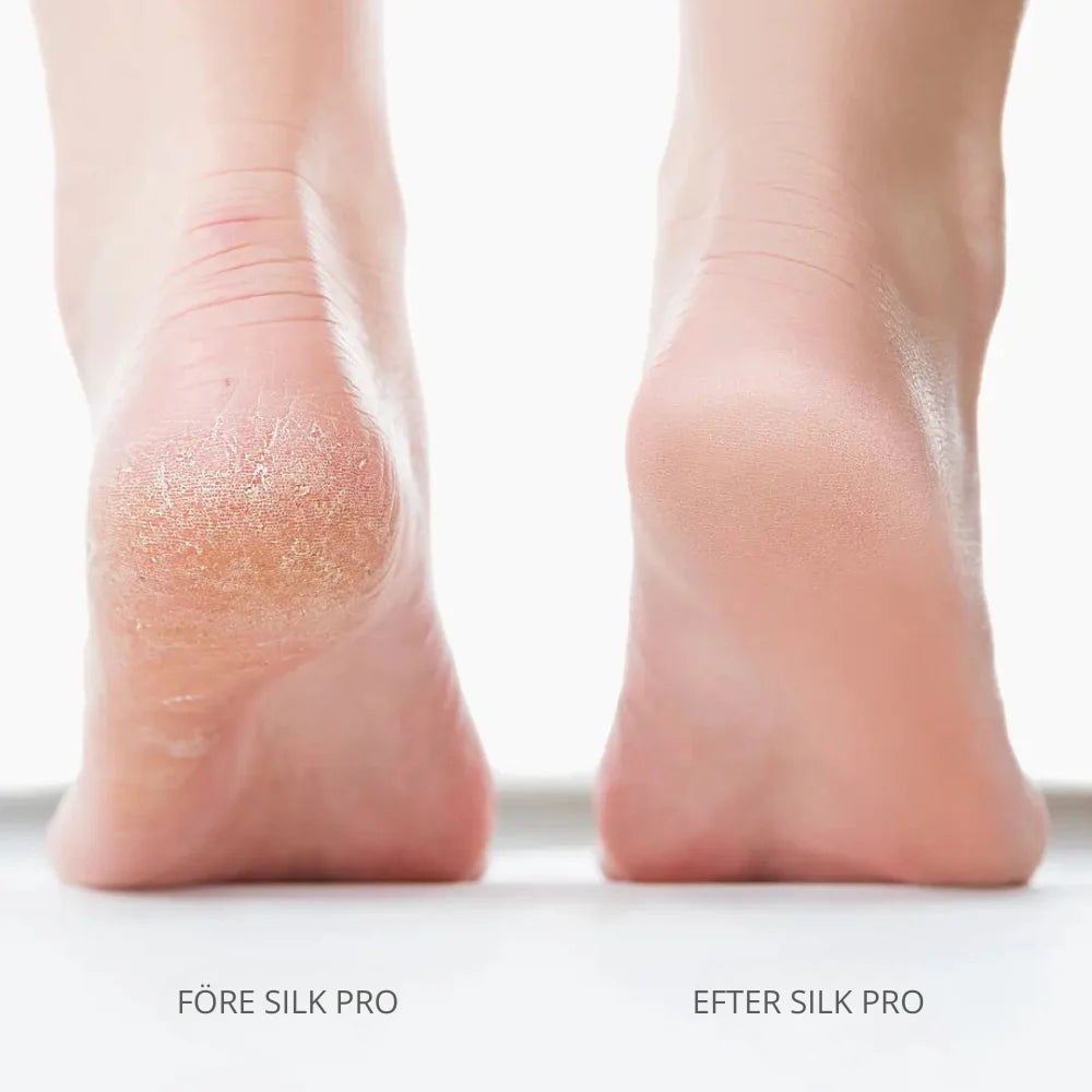 Bliss Silk Pro 2 – Soft feet without expensive salon visits