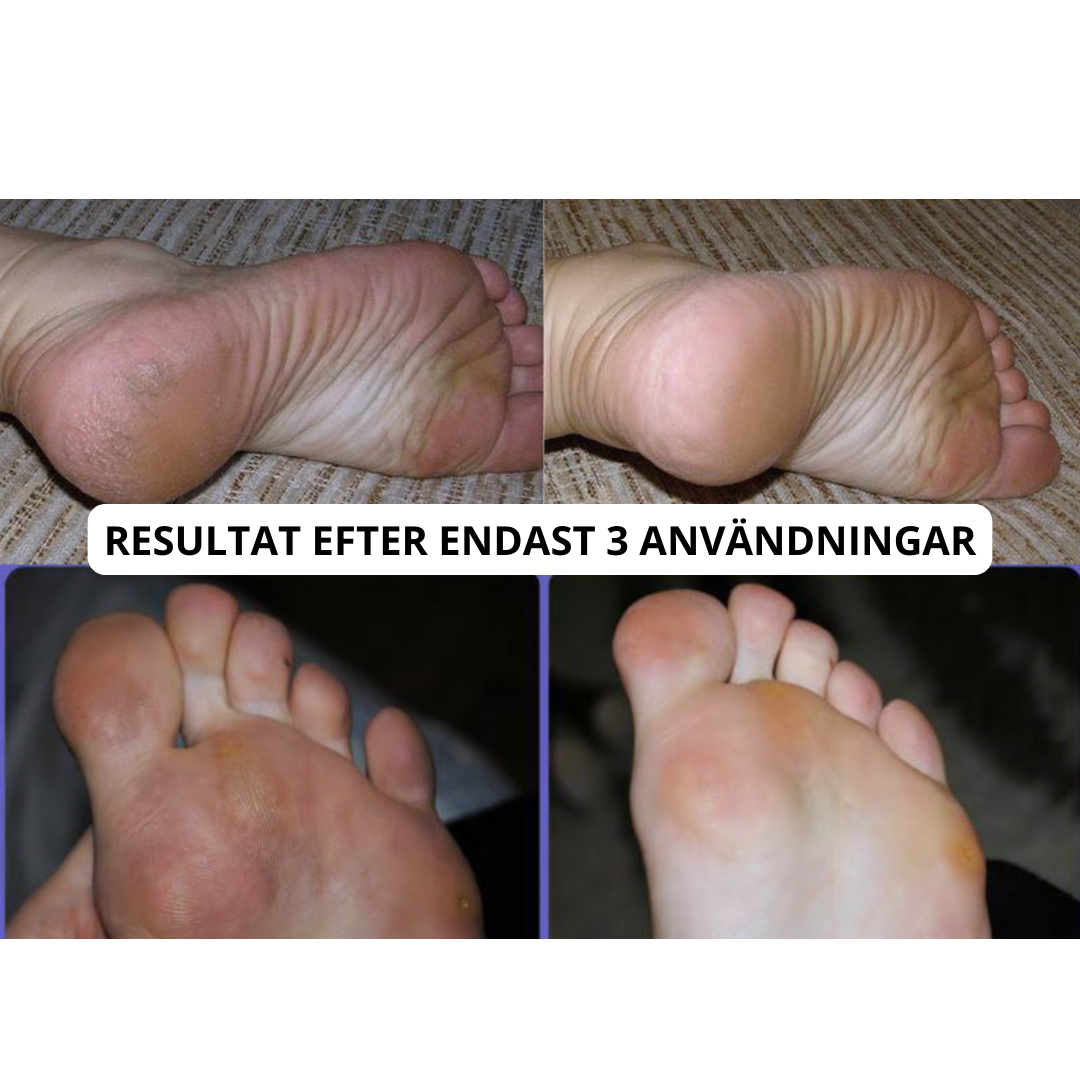 Electric Foot File Pro