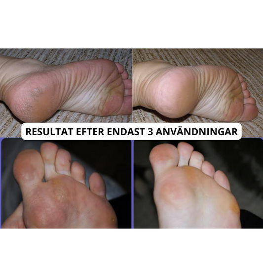 Electric Foot File Pro