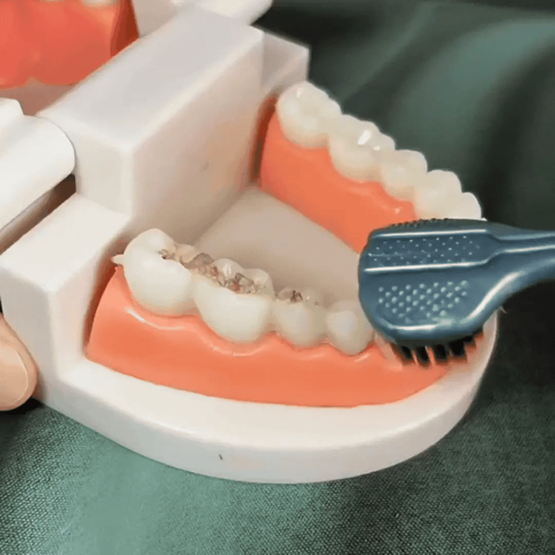 360Smile Pro- Advanced Toothbrush